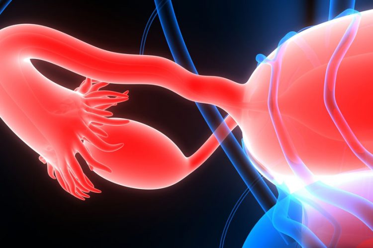 عوارض تنبلی تخمدان