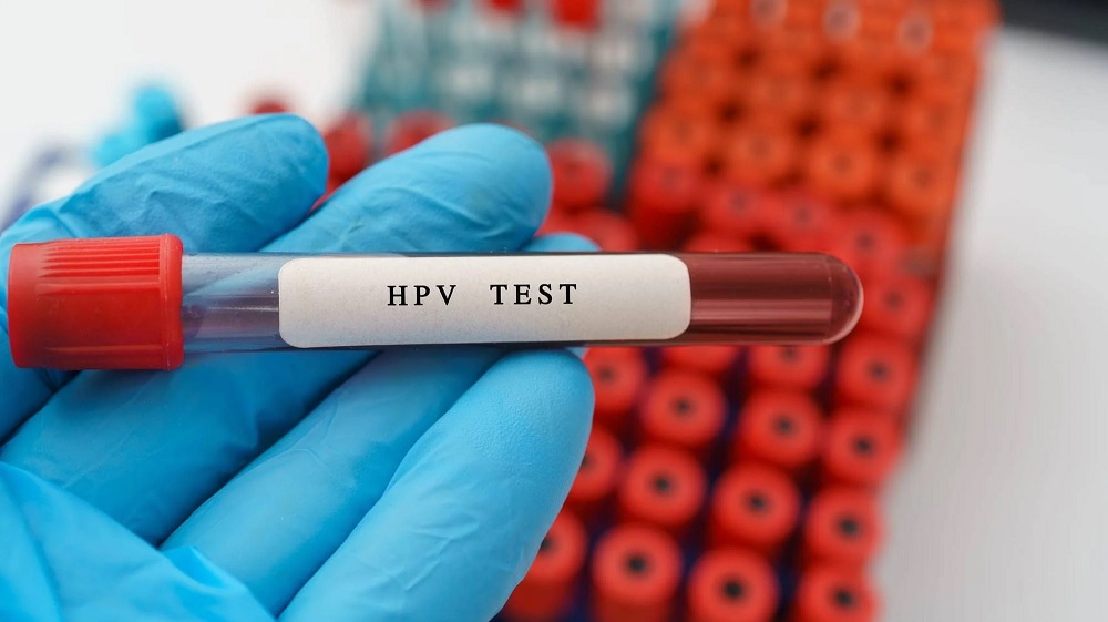 آزمایش hpv