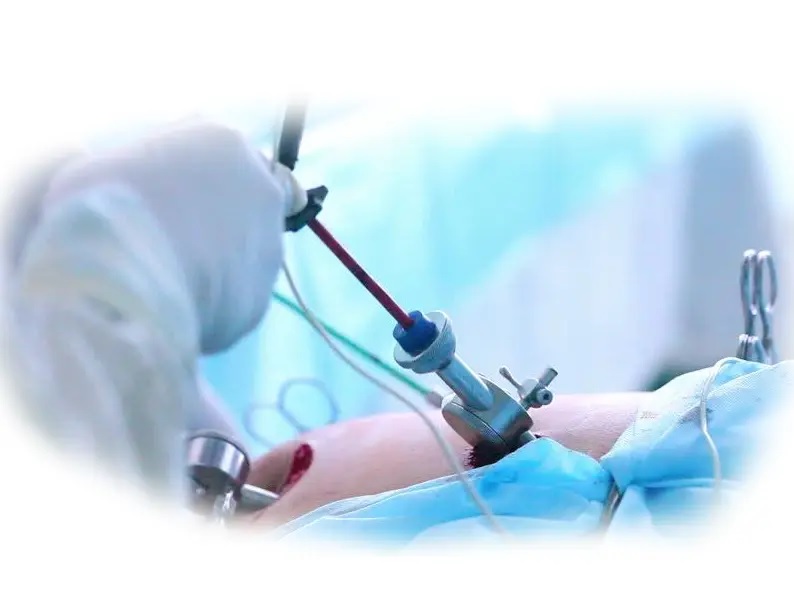لاپاراسکوپی رحم و تخمدان چیست؟ چقدر طول میکشد؟